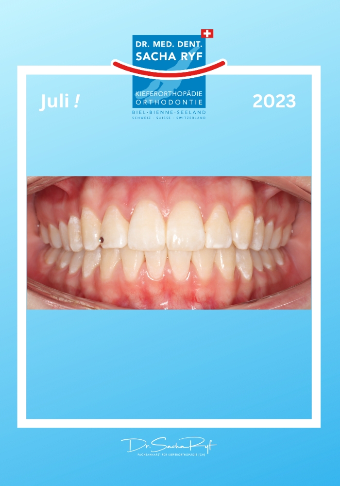 After-Lächeln des Monats