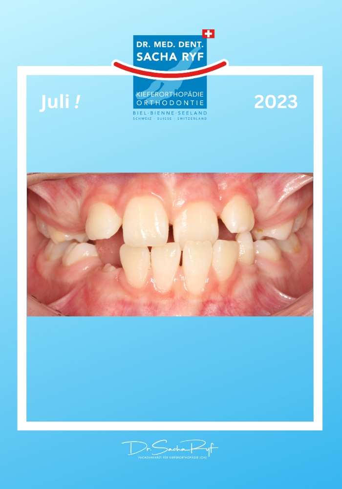 Before-Lächeln des Monats